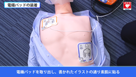 AEDの操作手順:電極パッドの装着