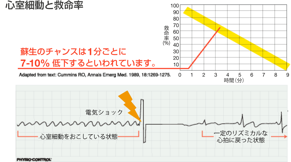 Aedの使用方法と心肺蘇生の手順 セコムaedパッケージサービス 医療