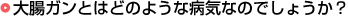 大腸ガンとはどのような病気なのでしょうか？