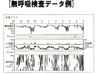 無呼吸検査データ例