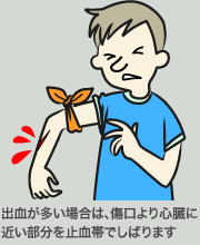 切り傷・はさみ傷の救急処置