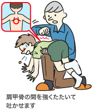誤飲の救急処置