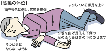 突然の意識障害の救急処置